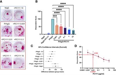 Blocking soluble Fas Ligand ameliorates pemphigus: PC111 efficacy in ex-vivo human pemphigus models